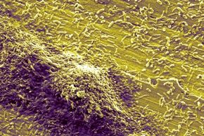 This biofilm – a sticky mass of bacteria – contains Legionella pneumophila and Hartmannella vermiformis.