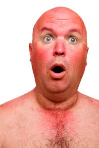 Man surprised at extent of sunburn.