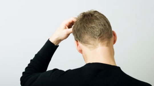 Itchy Scalp Causes and Treatments