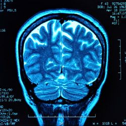 MRI brain blue