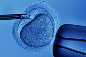 Pregnancy Image GalleryA microscopic view of sperm implantation duringin vitro fertilization.  See more pregnancy pictures.