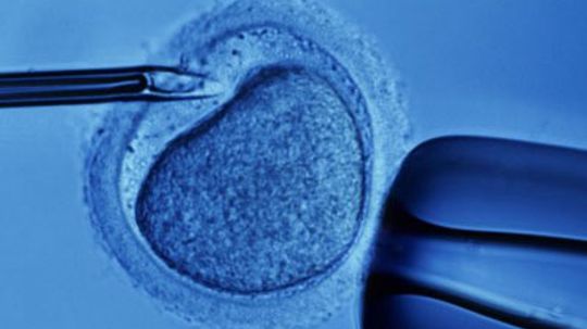 In Vitro Fertilization Overview