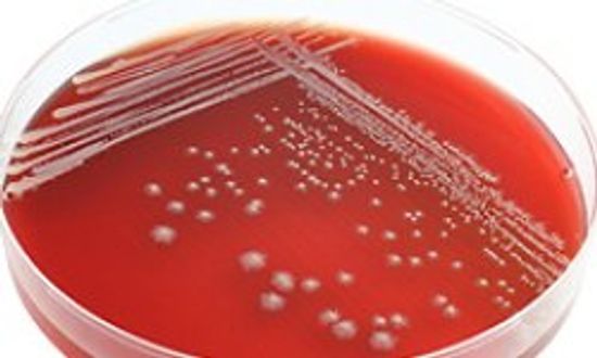 你能做青霉素过敏测试吗?＂class=