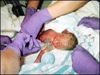 William was delivered via C-section.
