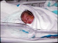 Baby William weighed only 2 pounds, 13 ounces at birth.