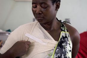 Sarah Nabwami adjusts her bandages in a Ugandan burn unit. As she worked at her restaurant, an assailant threw acid in her face on behalf of a jealous rival. He was fined 400,000 Ugandan shillings (about U.S. $250) and released.