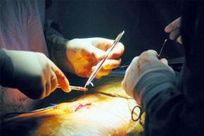 Traditional spinal surgery involves scalpels, or other precision cutting tools, and often entails opening up the back with a wide or long incision.