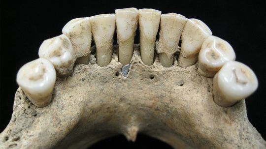 Lapis Lazuli Found in Teeth of Medieval European Woman