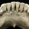 Lapis Lazuli Found in Teeth of Medieval European Woman