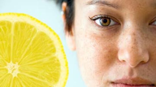 Does lemon juice really get rid of freckles?