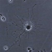 A phase-contrast image of a glial cell cultured from a rat brain