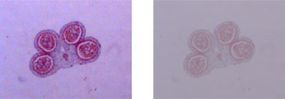 Image of pollen grain with good contrast (left) and poor contrast (right)