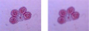 Image of pollen grain in focus (left) and out of focus (right)
