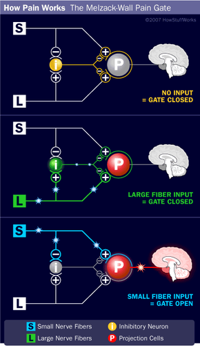 gate control theory of pain diagram