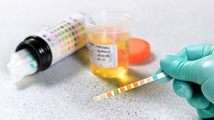 People have tried to beat a drug test with someone else's urine but labs are usually able to detect the difference. Peter Dazeley/Getty Images