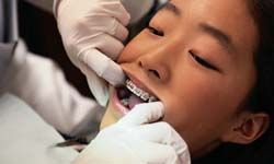 Young Asian girl at dentist office