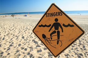 Peeing on a jellyfish sting might make the situation worse.
