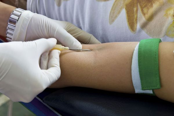Woman's arm being punctured with needle for blood donation.