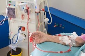 dialysis