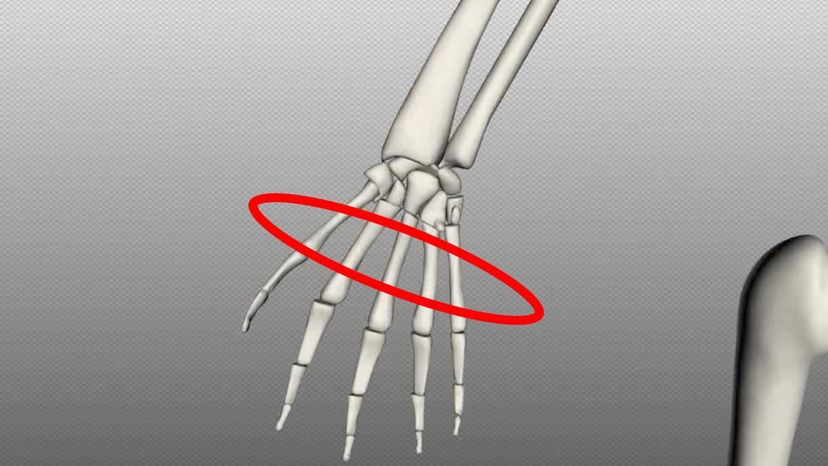 metacarpal bones