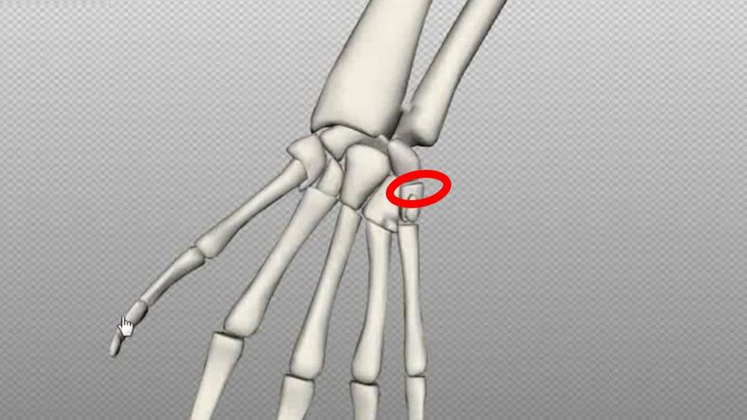 triquateral bone