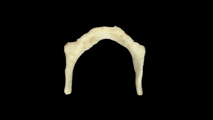 Hyoid