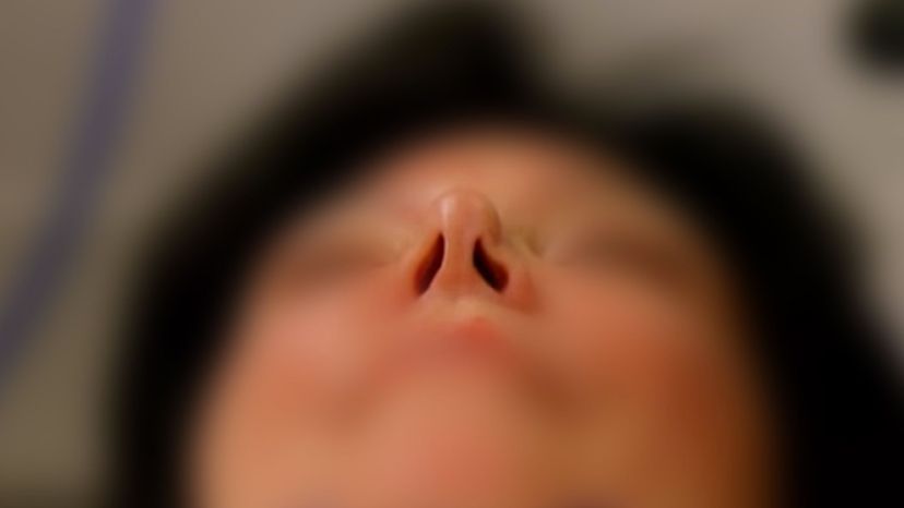 Kris' nose 