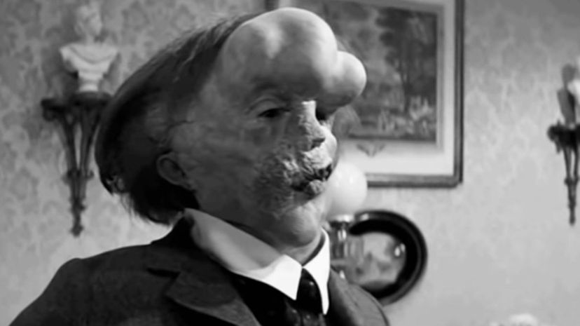 The Elephant Man