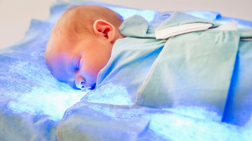 Phototherapy blankets