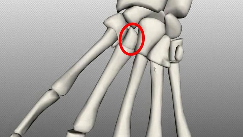 trapezoid bone