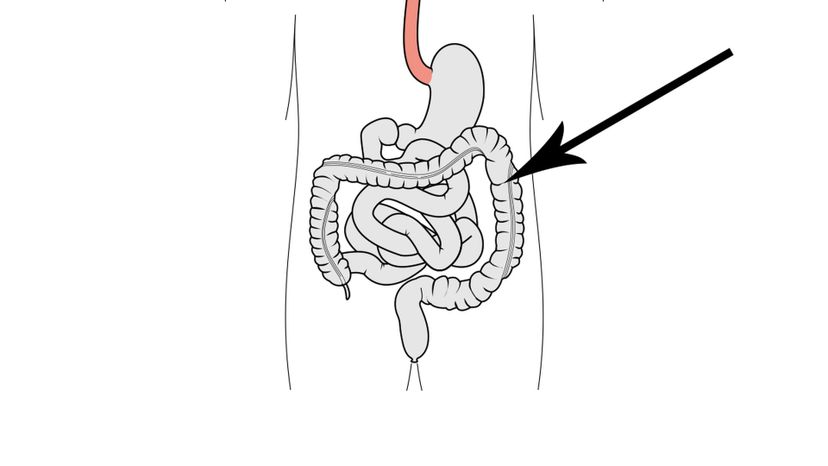 Large Intestine