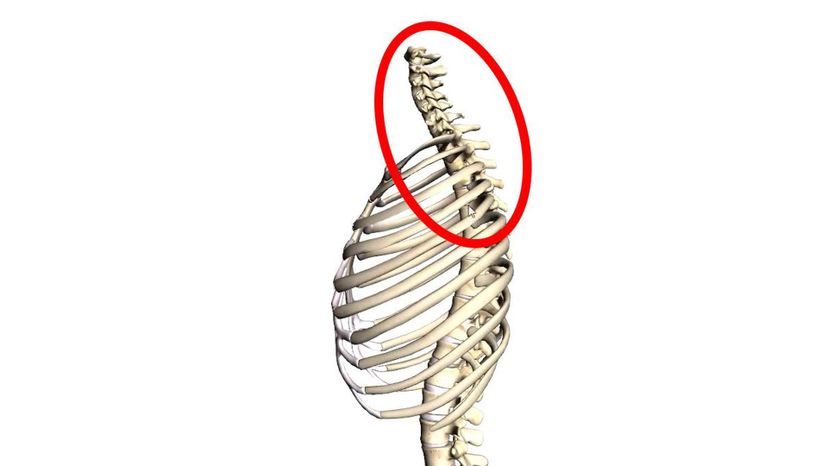 cervical vertebrae