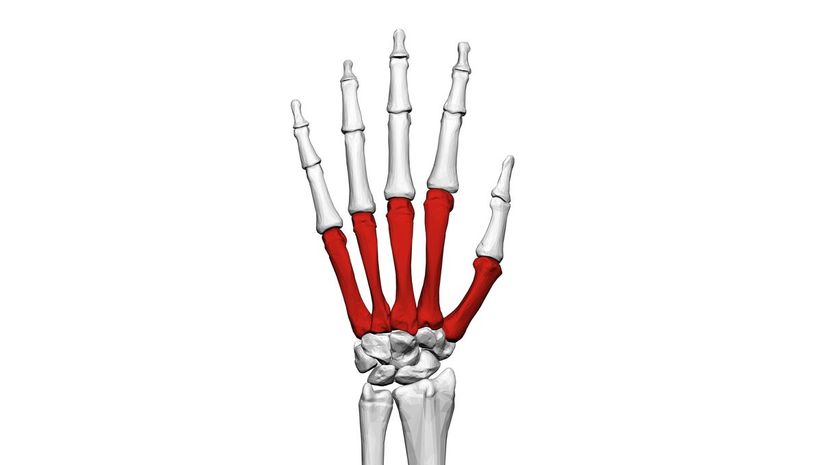 Metacarpal bones