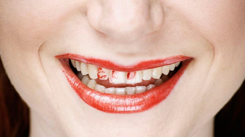 lipstick on teeth