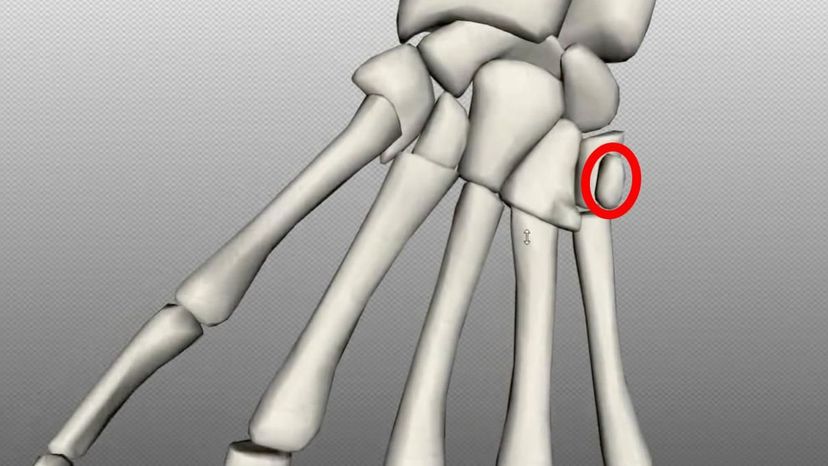 pisiform bone