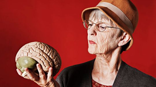What's Your Brain's Age?