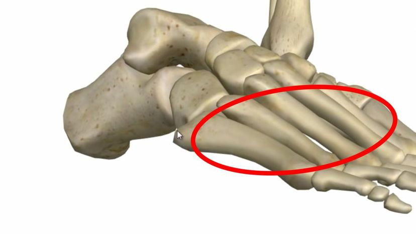 metatarsal bone