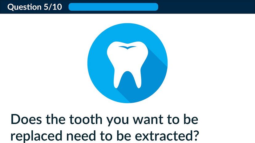 Does the tooth you want to be replaced need to be extracted?