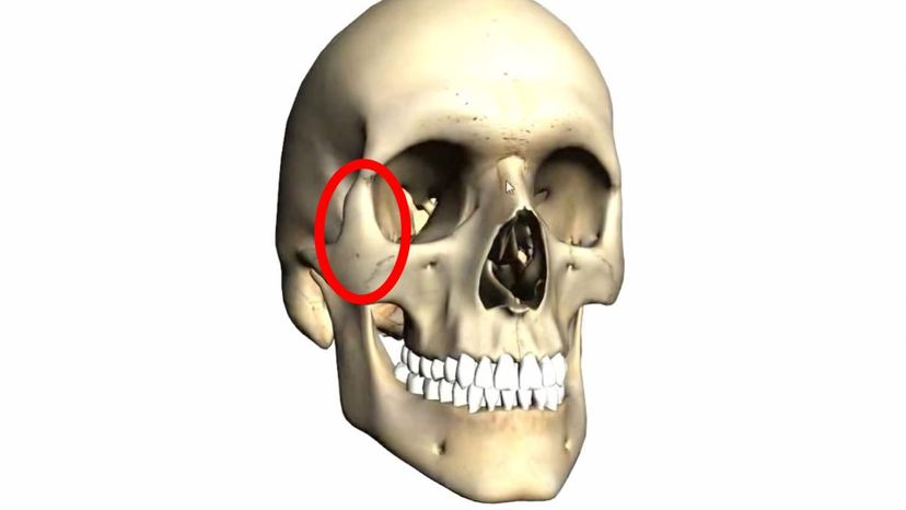 zygomatic bone