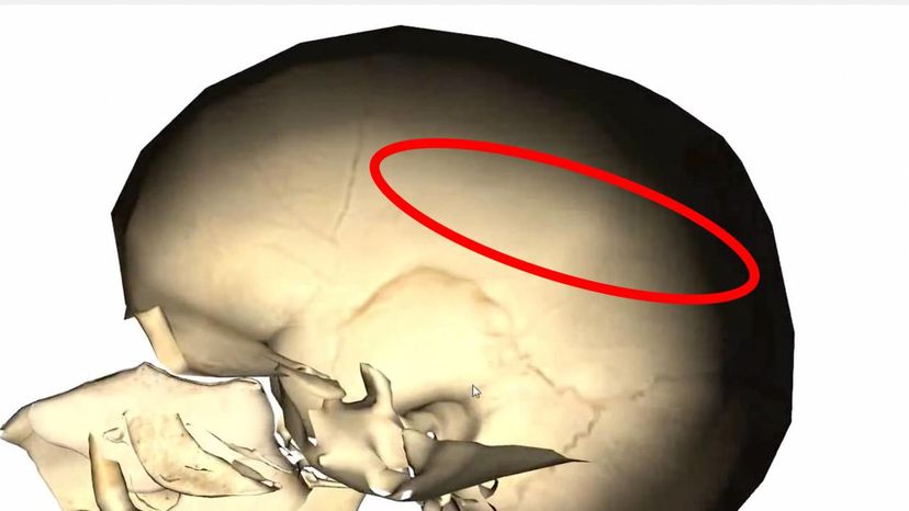 parietal bone