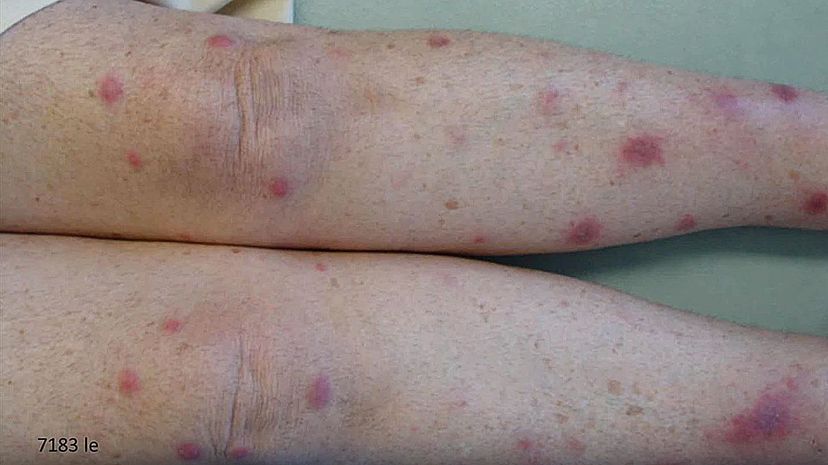 Question 14 - Sweets