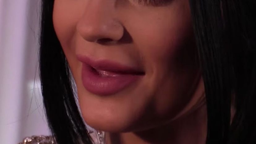 Kylie's nose 