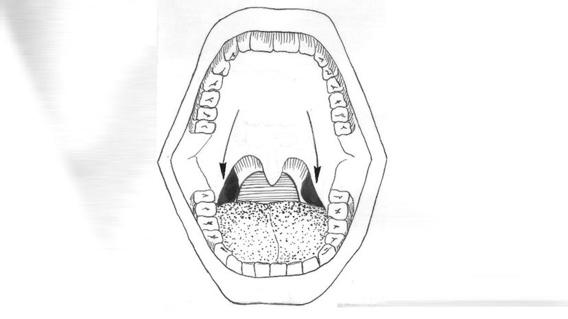Tonsils