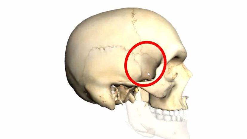 sphenoid bone