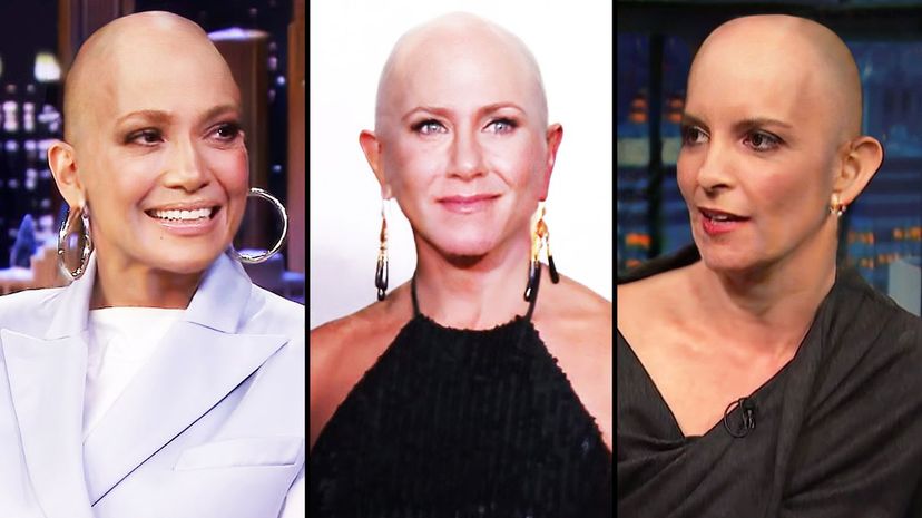 Can You Identify These Celebrities If We Make Them Bald?