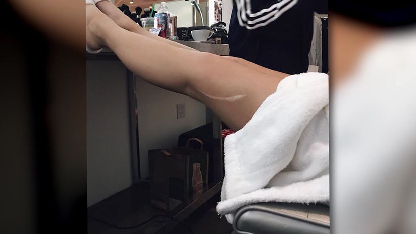 Kylie' legs 