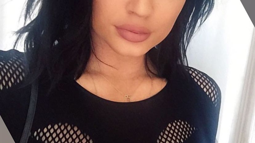 Kylie's lips 