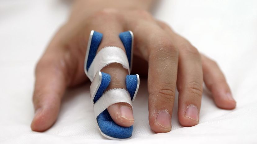 Finger SPlint