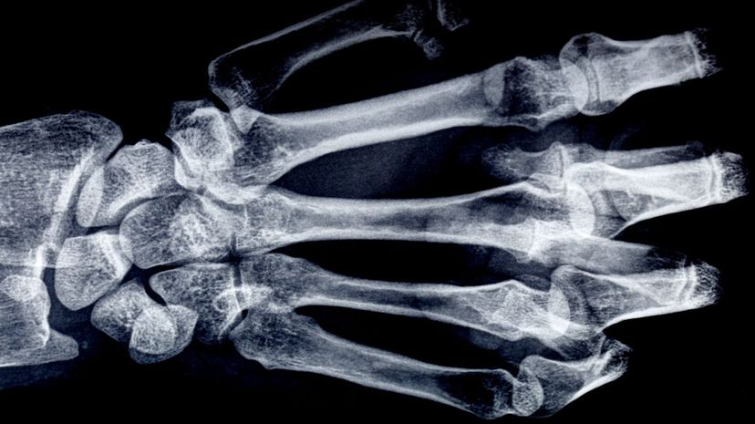 Can You Name the 35 Smallest Bones in the Human Body in Five Minutes?