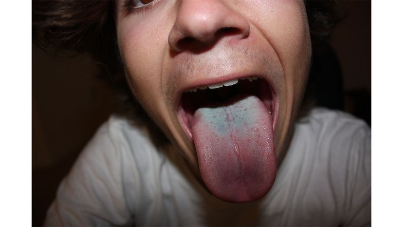 Tongue